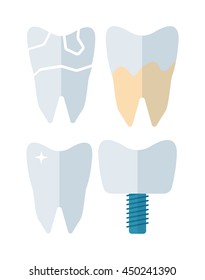 Tooth implant vector illustration