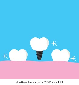 tooth implantation icon vector illustration