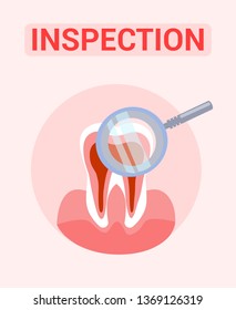 Tooth Inspection, Examination Flat Banner Concept. Dental Clinic, Orthodontic Diagnosis Service Poster. Tooth and Magnifying Glass Vector Illustration with Typography. Stomatology, Oral Sanitation