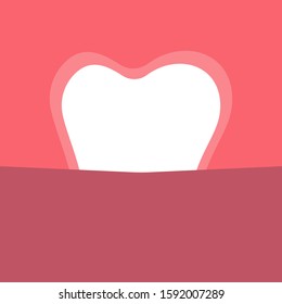 Tooth and invisible braces, concept. Technology for teeth alignment-silicone trainer. Vector stock illustration.