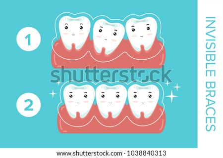 tooth with invisible braces on the blue background