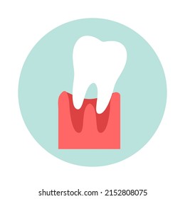 Tooth loss. Medicine, the concept of health care. The concept of dental care.