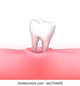 Tooth loss on white background. Vector illustration