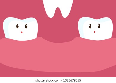 Tooth loss Vector illustration.