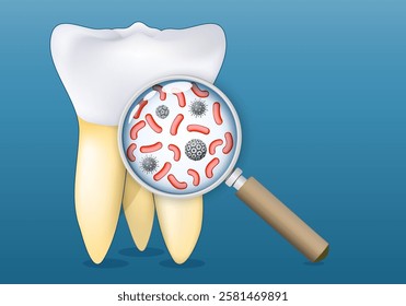Tooth and a magnifying glass that zooming in to bacteria and microorganisms present on the surface. Tooth decay. Bacterial biofilms and dental diseases. preventive dental care. Vector poster