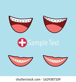 Tooth with metal braces or bracket system. Tooth Cure Orthodontics. Vector Illustration.