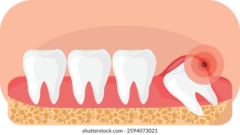 tooth pain vector due to cavity and wisdom tooth