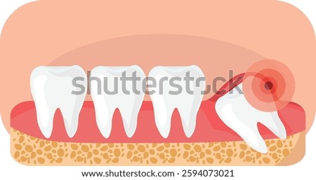 tooth pain vector due to cavity and wisdom tooth