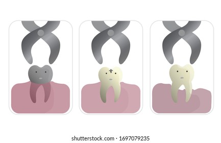 Tooth removal by extraction forceps in different kind of diseases