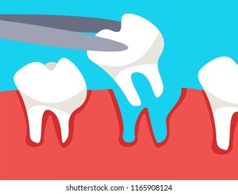 Tooth is removed by forceps. Extracted teeth. Flat vector illustration in cartoon style.