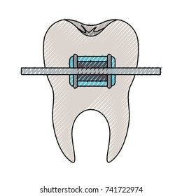 tooth with root and brace in colored crayon silhouette vector illustration