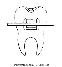tooth with root and brace in monochrome blurred silhouette vector illustration