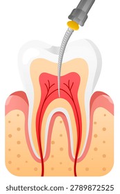 Tooth root canal dental drill endodontic dental care oral health dentistry dental treatment tooth anatomy medical illustration calm educational vector shows tooth root canal dental drill procedure
