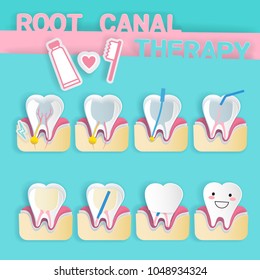 tooth with root canal therapy on the blue background