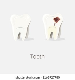 Tooth and Rotten Tooth