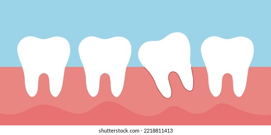 Tooth row . Dentistry . Vector
