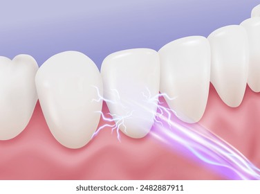 Tooth sensitivity pain feels like an electric shock, sharp shock of nerve pain in response to a hot, cold, sweet, or sour trigger. Realistic vector illustration.