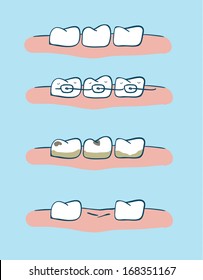 Tooth, set vector dental Illustrations. orthodontic treatment. 