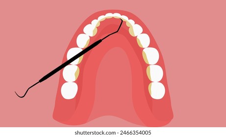 Limpieza de piedra dental, ilustración de color plano