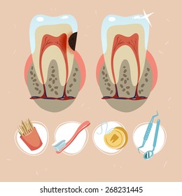 tooth structure. tooth with caries. dental floss, dentist tools, toothpicks, toothbrush with toothpaste icon set