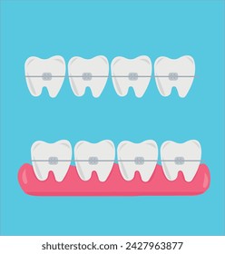 Tooth, teeth, implant, dental vector illustration set