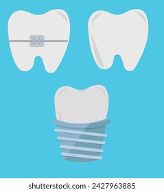 Tooth, teeth, implant, dental vector illustration set