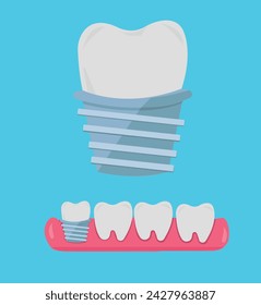 Tooth, teeth, implant, dental vector illustration set