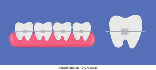 Tooth, teeth, implant, dental vector illustration set