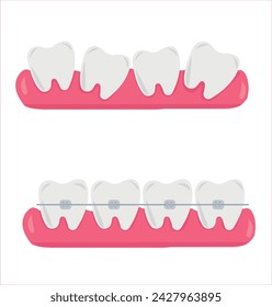 Tooth, teeth, implant, dental vector illustration set