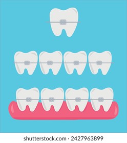 Tooth, teeth, implant, dental vector illustration set