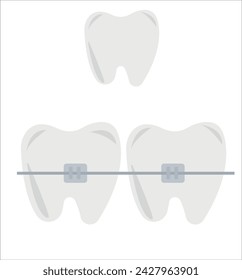 Tooth, teeth, implant, dental vector illustration set