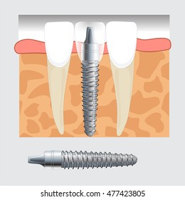 tooth vector 10,dentist, teeth vector 10