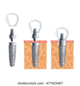 tooth vector 10,dentist, teeth vector 10