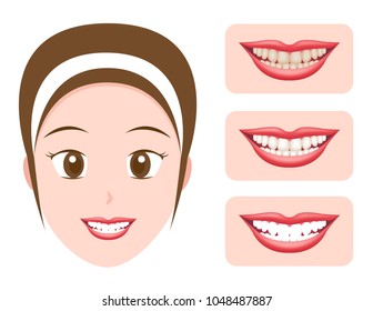 tooth Whitening Before After vector