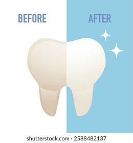 Tooth whitening illustration. Teeth Whitening. before and after veneers installation isolated on a white background. Teeth whitening. Dentistry, dental treatment. Comparison of the shape of teeth.