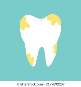 Tooth with yellow plaque. Isolated clipart in doodle, cartoon, flat style on blue background