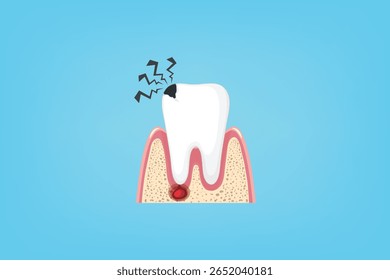 Ilustração de dor de dente com gengivas inflamadas e linhas de dor. Ótimo para problemas de saúde bucal e temas de diagnóstico dentário.