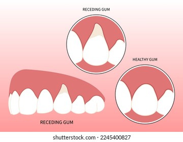 Toothache swelling Teeth dentistry grafting procedure for recession gummy smile buildup Loose black cavity root decay canal abscess oral pain thin injury cosmetic recontouring crown prep