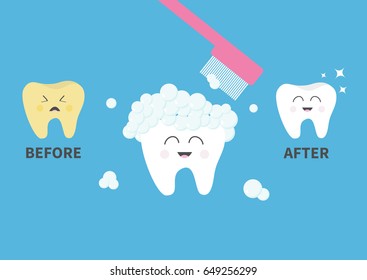 Toothbrush with toothpaste bubble foam. Healthy smiling white tooth icon. Crying bad ill yellow teeth. Before after infographic. Cute character set. Oral dental hygiene. Baby background. Flat Vector