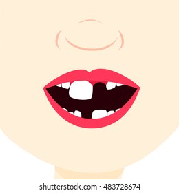 Toothless child smiling and showing milk tooth and permanent teeth in eruption. Close up in the mouth.