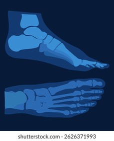 Top and side view of foot bones on x-ray flat drawing.