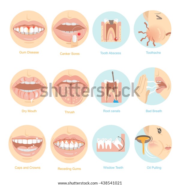 オーラルケアの問題点の上位12位 ベクターイラスト のベクター画像素材 ロイヤリティフリー