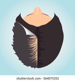 Top view of a balding woman before and after hair treatment. Divided image of the head. Two halves. Sticker revealing healthy scalp. Female alopecia. Isolated vector illustration.