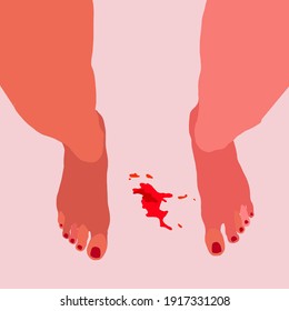 Top view of the girl's legs, bloodstain. Menstruation theme,  period. Feminine hygiene. Hand drawn vector illustration