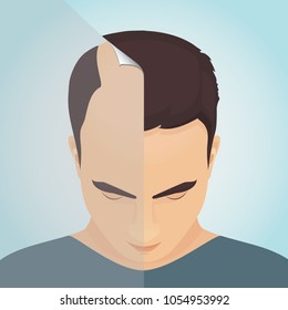 Top view portrait of a man before and after hair treatment and transplantation. Divided image of the head. Two halves. Sticker revealing healthy scalp. Isolated vector illustration.