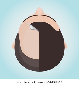 Top view portrait of a man before and after hair treatment and transplantation. Divided image of the head. Two halves. Sticker revealing healthy scalp. Isolated vector illustration.
