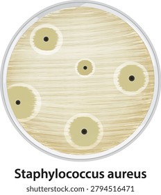 Top view vector illustration of Staphylococcus aureus colonies growing on agar within a petri dish