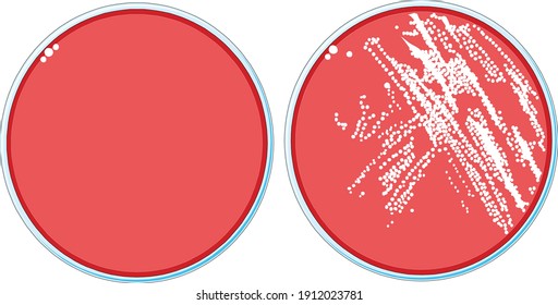 Top-view of two Petri dish with or without colonies of bacterial growth culture on blood agar media used in microbiology