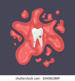 torn tooth in a pool of blood on a dark background