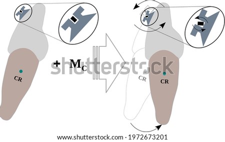 Torque experienced by a tooth due to the torque in the Bracket slot